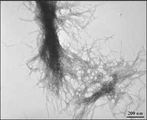 Трансмиссионный электронный микроскоп показывает фибриллярную природу скоплений белка хантингтина.
