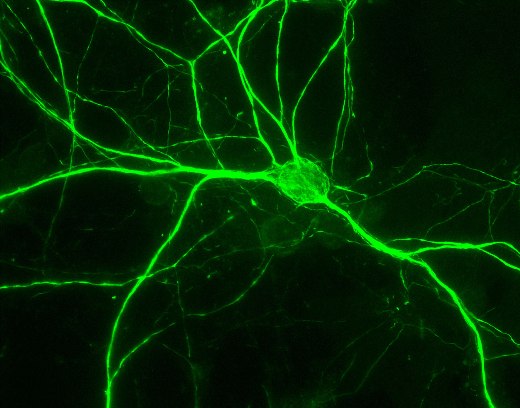 Кортикальный нейрон крысы
