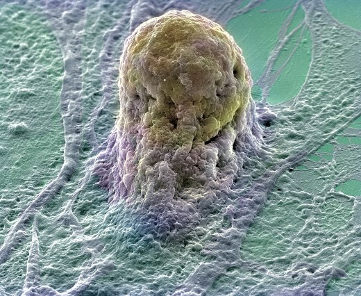 Стволовая клетка
