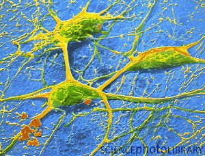 Три нейрона коры головного мозга человека (СЭМ)