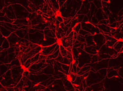 Красные объекты - бывшие мышиные эмбриональные фибробласты с тремя добавленными генами, побудившими их превратиться из клеток кожи в нейроны.