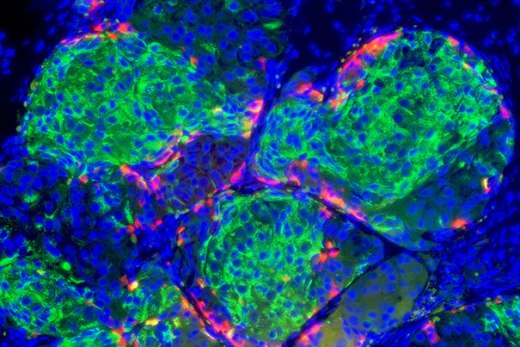 Полученные из стволовых клеток бета-клетки образовали у мышей структуры, близкие к островкам поджелудочной железы. Через две недели после трансплантации в почки они начали синтезировать инсулин.