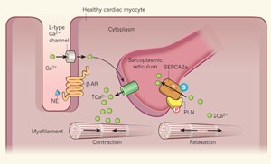 В здоровом кардиомиоците норадреналин (NE), высвобождаемый симпатическими нервами, стимулирует β-адренергические рецепторы (β-AR), повышая активность кальциевых ионных каналов L- типа на мембране клетки, что приводит к поступлению в клетку кальция. Это, в свою очередь, вызывает высвобождение большого количества кальция из саркоплазматического ретикулума в цитоплазму и приводит к сокращению миофиламентов. Норадреналин также стимулирует фосфорилирование (Р) фосфоламбана (PLN), оказывая тормозящее действие на Ca2+-ATPазные насосы саркоплазматического ретикулума – SERCA2a. Активированный SERCA2a связывает ионы кальция в цитоплазме и переносит их обратно в саркоплазматический ретикулум, что способствует расслаблению миофиламентов. Только модифицированный белком SUMO-1(S) SERCA2a может транспортировать ионы кальция и поддерживать здоровье сердца. При сердечной недостаточности количество SUMO-1 снижается и SERCA2a остается в немодифицированной форме, в которой он не может связывать АТФ и эффективно перекачивать кальций в саркоплазматический ретикулум. При этом страдает способность сердечной мышцы к расслаблению.