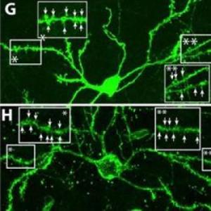 Медиальные шипиковые нейроны (зеленые), интегрирующиеся в существующие нервные сети.