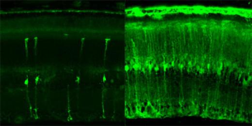 Клетки глаза успешно поглощают вирус, несущий ген зеленого флуоресцентного белка. На снимке хорошо видно, что инженерный штамм аденоассоциированного вируса (справа) более эффективен, чем его предшественник – стандартный вирус. Особенно успешно новый штамм доставляет гены в критически важные фоторецепторы (верхний слой).