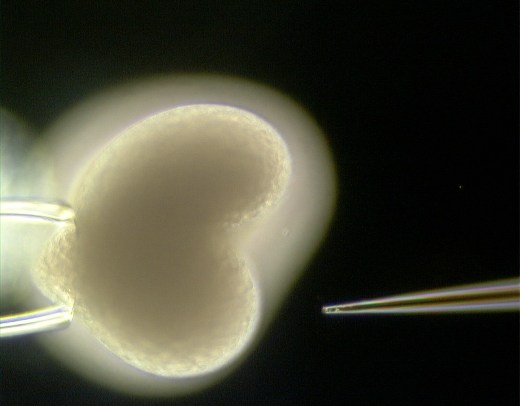 В эмбрион гидры вводится генетическая последовательность.