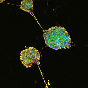 Синий, зеленый, красный и желтый цвета на этом изображении показывают, что эти нейроны вырабатывают белки типичные для незрелых нервных клеток – доказательство того, что они вернулись к состоянию близкому к стволовому. Ученые Института Солка установили, что зрелые корковые нейроны способны вернуться в это незрелое состояние и развиться в агрессивный тип опухоли головного мозга, который, как считалось ранее, развивается только из нейральных стволовых или глиальных клеток.