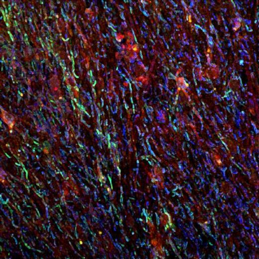 Иммунофлуоресцентная визуализация головного мозга пациента с рассеянным склерозом с активным поражением ткани. Показаны астроциты (синие), арил-углеводородный рецептор (красный) и фосфорилированный STAT1 (signal transducer and activator of transcription 1) (зеленый).