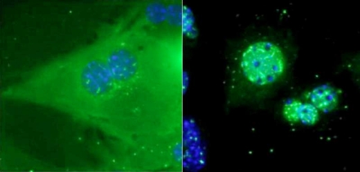 Слева: в клетках печени так называемые гистоновые деацетилазы класса II (показаны зеленым), как правило, находятся вне ядра.  Справа: в ответ на глюкагон HDACs  быстро перемещаются в ядро, где они помогают включать гены, необходимые для синтеза глюкозы в печени.