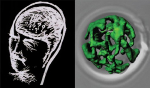 В нервных клетках пациентов с болезнью Альцгеймера блокируются митохондрии (зеленые)