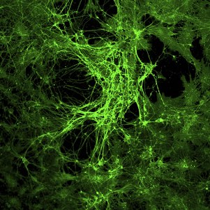 Нейроны гиппокампа мыши, экспрессирующие зеленый флуоресцентный белок.