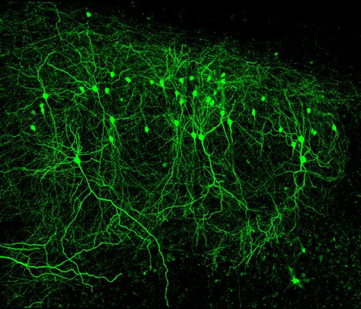 Нейроны гиппокампа мыши.