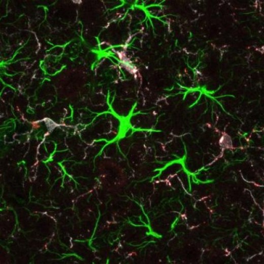 Белок хантингтин, связанный с болезнью Хантингтона, играет важную роль в раннем развитии головного мозга. В мозге пятинедельной мыши с удаленным хантингтином наблюдаются признаки клеточного стресса – активированные астроциты (зеленые) и клетки микроглии (белые и красные) и дефектные синапсы – в нервных сетях, уже связанных учеными с этим заболеванием.