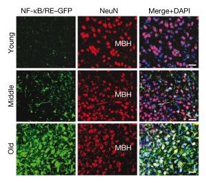 Активация NF-кВ в нейронах гипоталамуса с возрастом усиливается (левый столбец), в то время как общее количество нейронов (средний столбец) и общее количество клеток всех типов (правый столбец) в гипоталамусе  поддерживается на относительно постоянном уровне у всех возрастных групп.