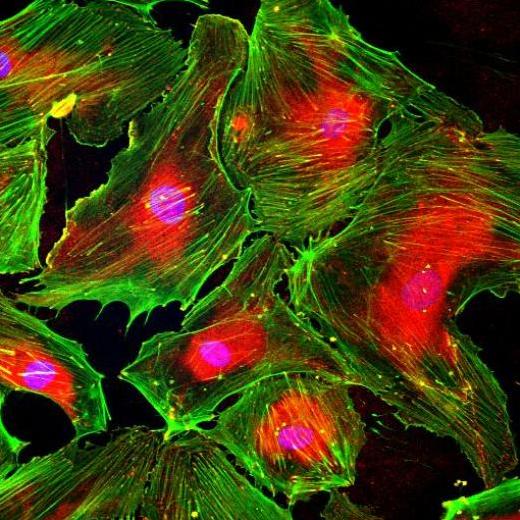 Человеческие эндотелиальные клетки-предшественники в культуре, окрашенные на фибриллярный актин (зеленый), белки фокальных адгезий (красные) и ядра (синие).