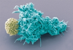 Дендритная клетка (справа) взаимодействует с Т-лимфоцитом. Сканирующий электронный микроскоп.
