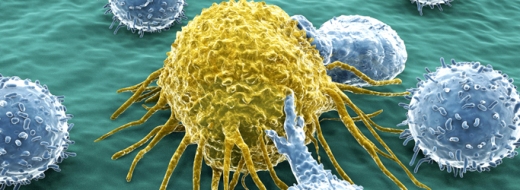 Раковая клетка под атакой лимфоцитов