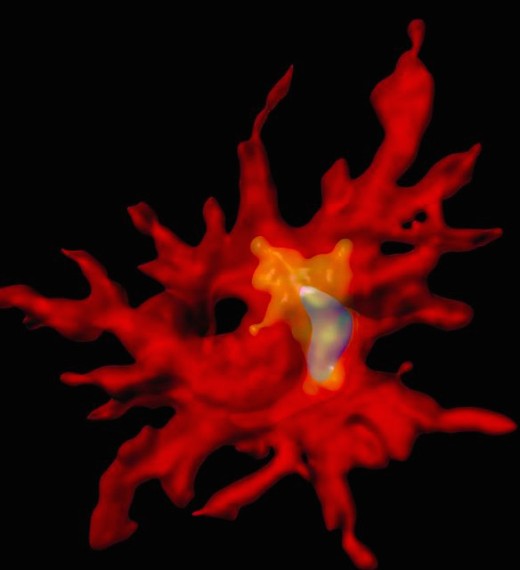 3D-реконструкция иммунной клетки (красная), содержащей β-амилоид (синий) в компартменте, где происходит его разрушение (желтый). Удаление противовоспалительного цитокина интерлейкина-10 активизирует клетки врожденной иммунной системы, очищая тем самым мозг от токсичных β-амилоидных бляшек.