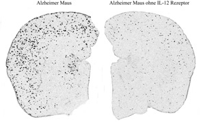 Ингибирование молекул сигнальных путь IL-12 и/или IL-23 оказывает существенное влияние на патологические изменения, характерные для болезни Альцгеймера, изображенные здесь как так называемые амилоидные бляшки (области с черными точками). Слева: полушарие мозга мыши с моделью болезни Альцгеймера; справа: полушарие мозга мыши с моделью болезни Альцгеймера без рецепторов IL-12.