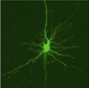 Оптическая импульс-маркировка белков для их отслеживания в клетках мозга. Нейрон стриатума с активированным белком Dendra2.