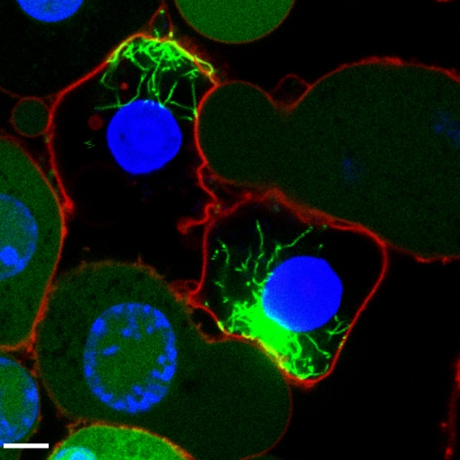 На снимке: макрофаги, содержащие активированные инфламмасомы. Ранее равномерно распределенные молекулы ASC (зеленые) образуют фибриллярные структуры. Ядра клеток окрашены синим; плазматические мембраны – красным.