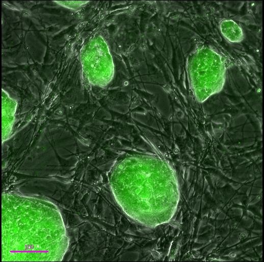 Индуцированные плюрипотентные стволовые клетки мыши, полученные с помощью микроРНК – метода, разработанного в лаборатории профессора Морриси. Зеленая флуоресценция указывает на экспрессию гена Oct4, являющегося маркером плюрипотентных стволовых клеток.
