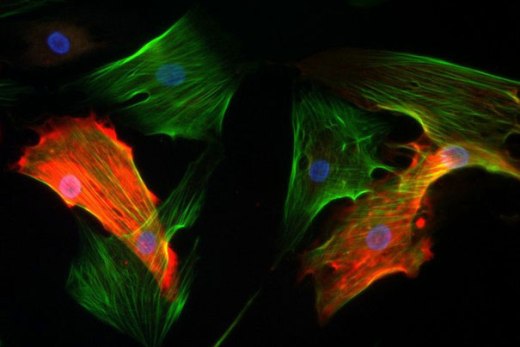 Выращенные в культуре перициты (красные) и миофибробласты (зеленые) – два важных вида нераковых клеток опухоли.