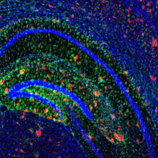 Амилоидные бляшки (показаны красным) испещряют мозг мыши с моделью болезни Альцгеймера