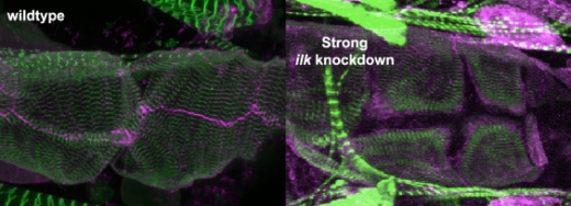 Сердце дрозофилы дикого типа (слева);  в сердце дрозофилы с нокдауном ILK наблюдаются «пробелы» между клетками.