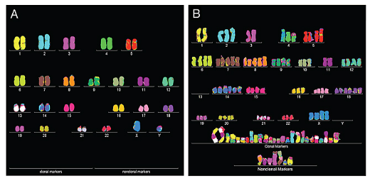 Окрашивание хромосом разными красителями подчеркивает упорядоченный характер нормального кариотипа человека (слева) – каждая хромосома представлена двумя своими точными копиями. Клетка рака мочевого пузыря (справа) имеет дополнительные копии некоторых хромосом, много гибридных, или маркерных, хромосом, характеризующих раковые клетки; несколько нормальных хромосом в ней отсутствуют.