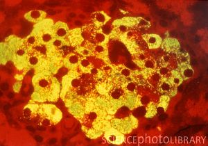 Световая микрофотография бета-клеток островков Лангерганса поджелудочной железы млекопитающих