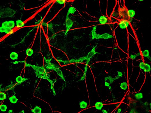 Смешанная культура клеток мозга крысы. Клетки окрашены на коронин 1а (coronin 1a), встречающийся только в микроглии (показан зеленым), и  альфа-интернексин (alpha-internexin) (показан красным), участвующий в нейронных процессах.