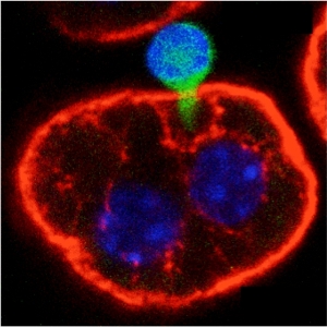 Т-клетка (сине-зеленая) втягивается в клетку печени мыши. В отличие от большинства клеток гепатоциты имеют 2 ядра, которые видны как 2 синие окружности.