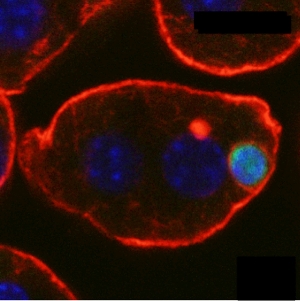 Т-клетка (сине-зеленая) полностью поглощена гепатоцитом мыши (красный). Две синие окружности – ядра гепатоцита.
