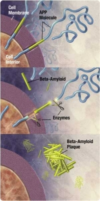 Белок-предшественник амилоида (АРР) разрезается ферментами с образованием бета-амилоида, накапливающегося в виде бета-амилоидных бляшек в межнейронном пространстве.