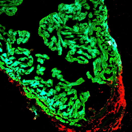 Пролиферирующие клетки в области повреждения в сердце данио (красные) и кардиомиоциты (зеленые).