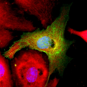 После про-восстановительной обработки ингибиторами микроРНК клетки сердечной мышцы возвращаются в состояние, близкое к состоянию клеток-предшественников. Зеленым показан дезорганизованный цитоскелет кардиомиоцита, указывающий на дедифференцировку клетки; красным – организация митохондрий.