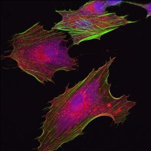 Мезенхимальные стволовые клетки