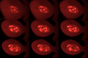 Ядра клеток железы ротовой полости: клеточным ядрам соответствуют внутренние овальные области. Матричные РНК в ядрах помечены флуоресцентными красителями и светятся при облучении лазером.