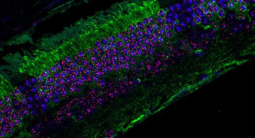 Глаз химерной мыши. В зеленых клетках – сверхдлинные теломеры (красные).