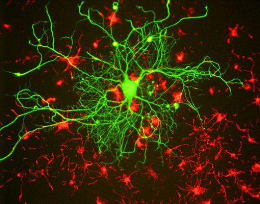 Нейрон в тканевой культуре