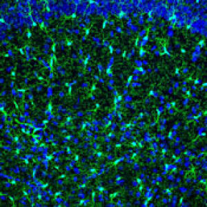 Микроглия (зеленая) в мозге мыши. Ядра всех клеток мозга помечены голубым.