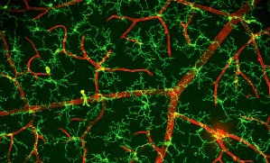 Образец ткани  сетчатки глаза. Зеленые клетки вокруг красных кровеносных сосудов – микроглия. В желтых областях кровеносные сосуды и микроглия перекрываются. И микроглия,  и  сосуды окружены нервными клетками сетчатки, не показанными на этом снимке.