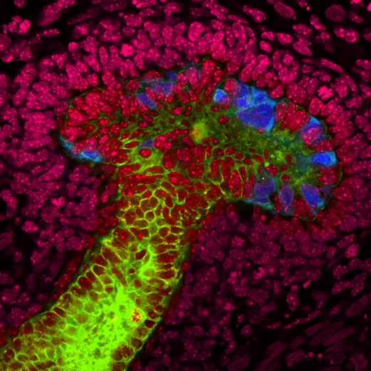Ученые из Института Солка вырастили из человеческих стволовых клеток зачатки мочеточников – почечных структур, отвечающих за реабсорбции воды. Чтобы направить развитие человеческих стволовых клеток в грибовидные зачатки мочеточников (голубые и зеленые), они использовали клетки почек мышиных эмбрионов (красные). Это достижение – важный шаг в развитии методов регенеративной медицины в области лечения почечных заболеваний.