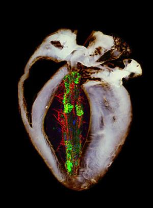 Сердце мыши (показано серым) демонстрирует признаки сердечной недостаточности, так как в нем отсутствует белок Mfn2, недавно идентифицированный как ключевая молекула процесса отбраковки митохондрий. На сердце мыши наложена трубка сердца плодовой мушки, показанная в цвете. Она также демонстрирует признаки недостаточности, поскольку в ней отсутствует белок паркин – другая ключевая молекула системы контроля над качеством митохондрий. Молекулы, вовлеченные в развитие сердечной недостаточности, играют роль и в развитии болезни Паркинсона.