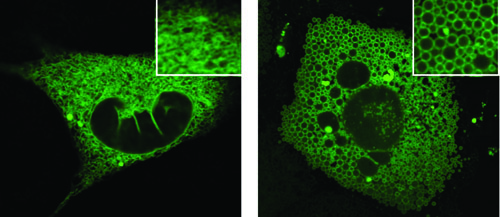 Эндоплазматический ретикулум клетки с белком Mfn2 (слева) и без него. Справа: ЭР образует везикулы, указывающие на полную дезорганизацию органеллы и неспособность адекватно реагировать на клеточный стресс.
