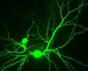При болезни Альцгеймера связи между нейронами (показаны здесь зеленым) нарушаются аберрантным белком SNO-Cdk5.