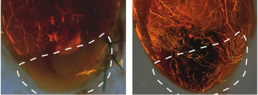 Введение мышам с моделью инфаркта миокарда модифицированной матричной РНК, кодирующей фактор роста VEGF-A, заметно улучшает кровоснабжение сердечной мышцы (справа)  по сравнению с контролем.