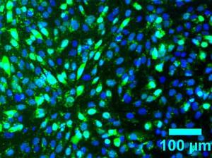 «Маячки» для клеток костной ткани. Светящиеся зеленые пятна в костных клетках MG-63 (каждая синяя точка – ядро) показывают, что флуоресцентная молекула-«маячок» связалась с РНК, синтезируемой при экспрессии специфического для костной ткани гена ALPL.