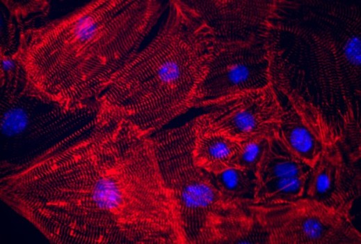Эти сокращающиеся клетки сердца перепрограммированы из клеток кожи с помощью химического коктейля и одного генетического фактора (Oct4). В перепрограммировании клеток ученые все меньше полагаются на подходы, основанные на генах, что открывает путь фармакологическим подходам, которые легче транслировать в успешные терапевтические методы.